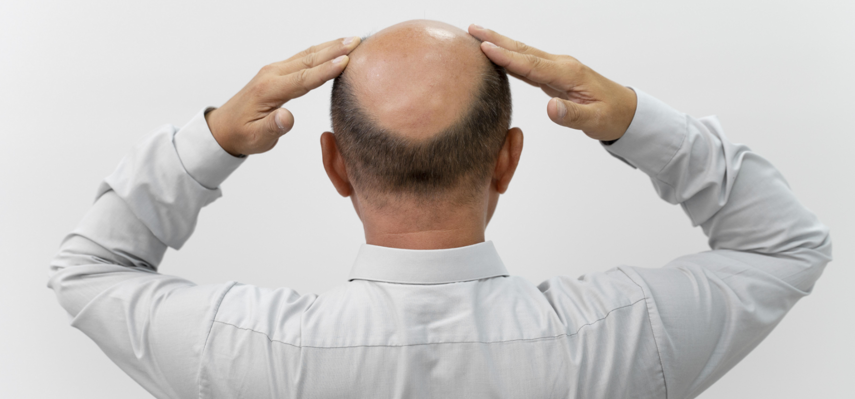 Main reasons for hair loss in Men